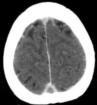 Neurovascular Medicine